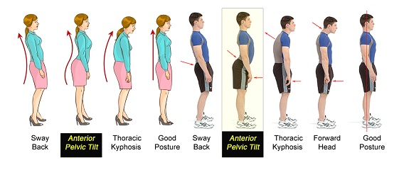 Correct Posture1